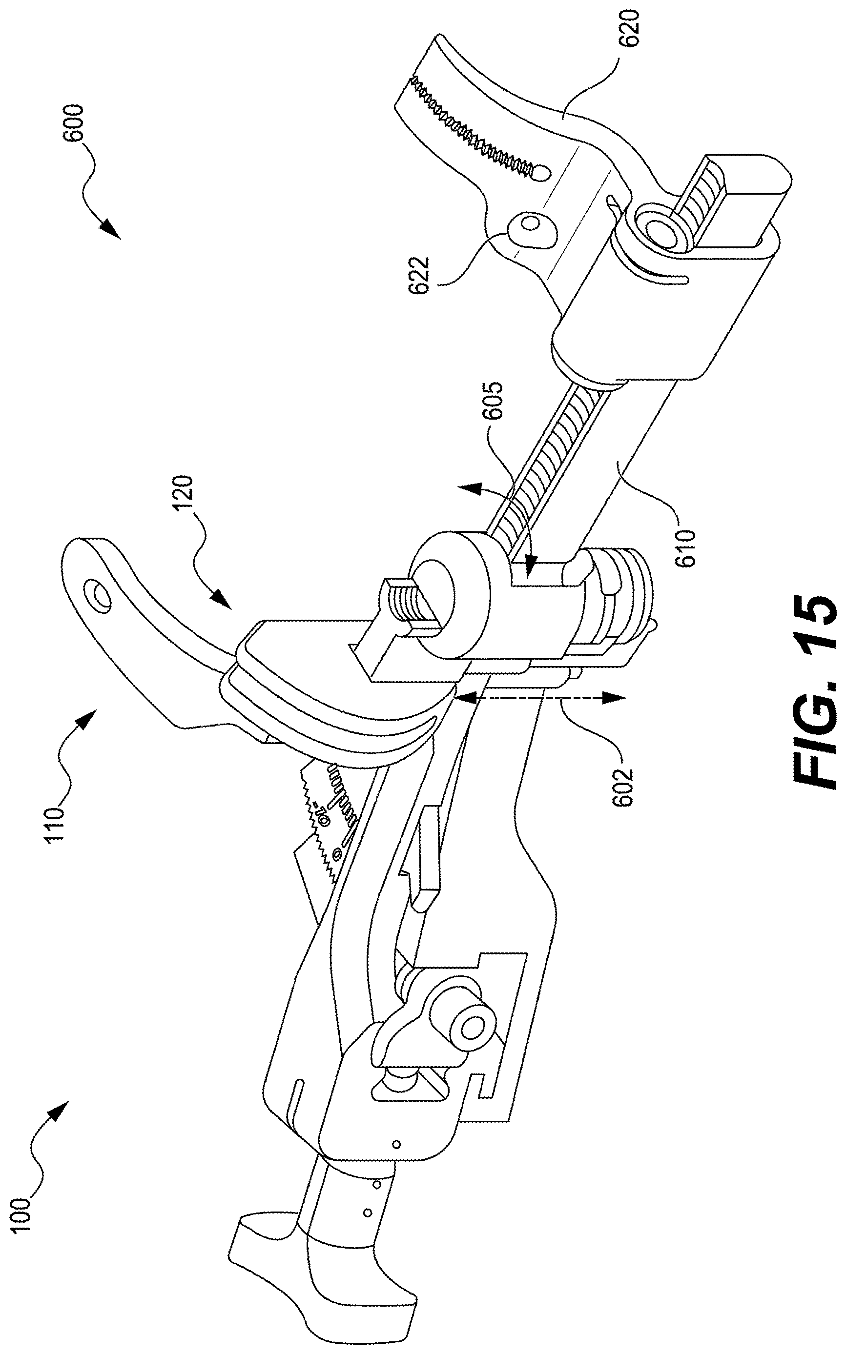 Patent US12616487 Figure 14 – Minimally invasive surgery lapidus system