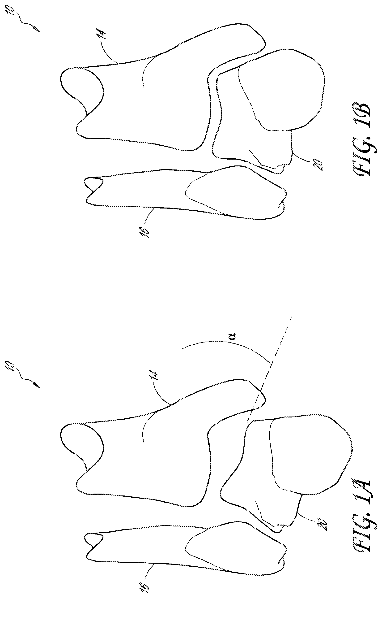 Patent US12616488 — Patient specific instruments and methods for joint prosthesis — Figure 1