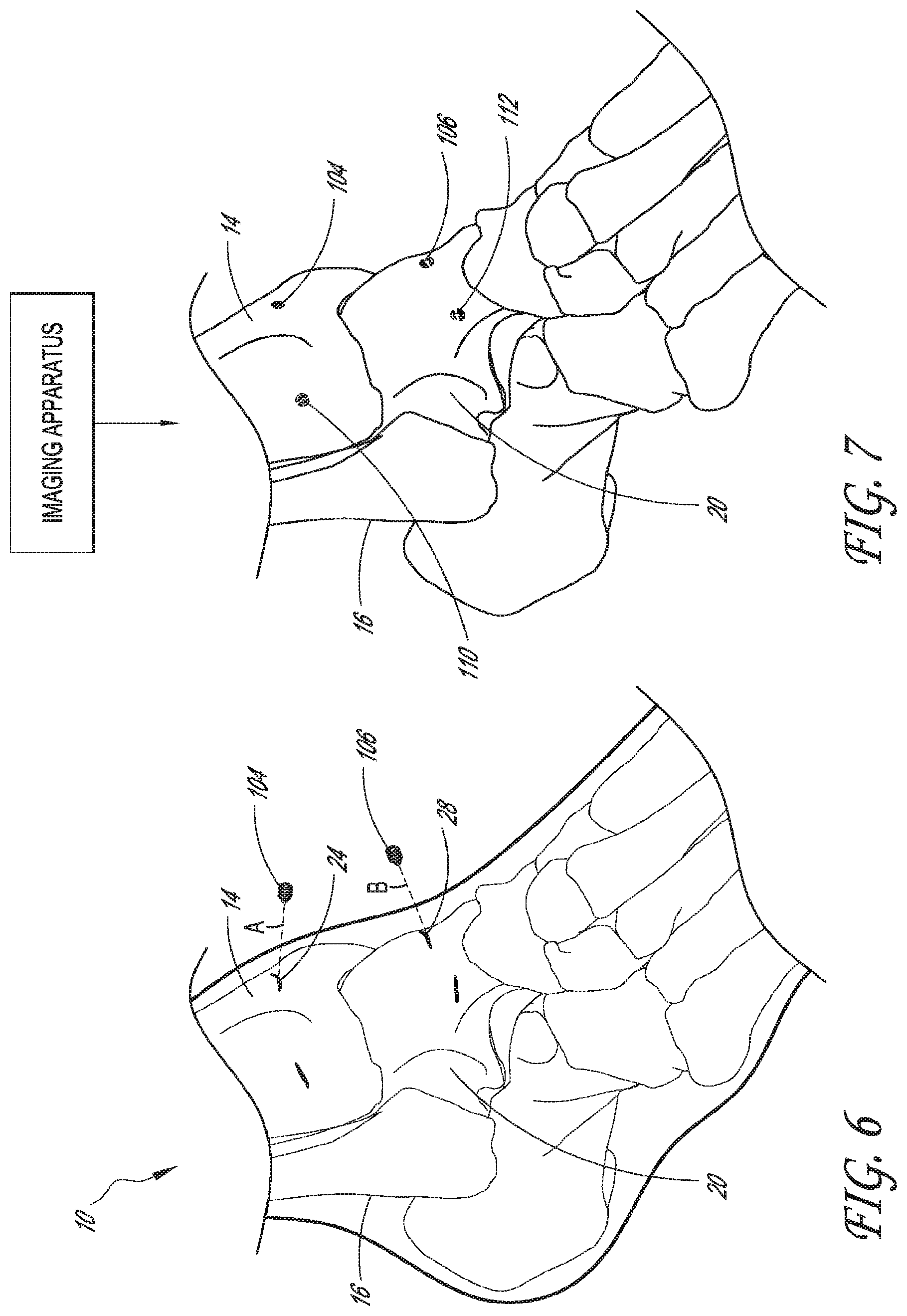 Patent US12616488 Figure 5 – Patient specific instruments and methods for joint prosthesis