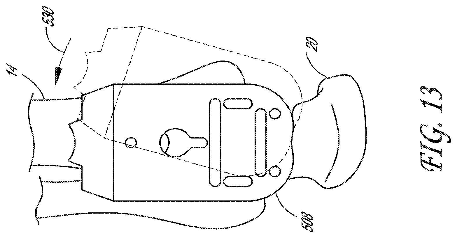 Patent US12616488 Figure 10 – Patient specific instruments and methods for joint prosthesis