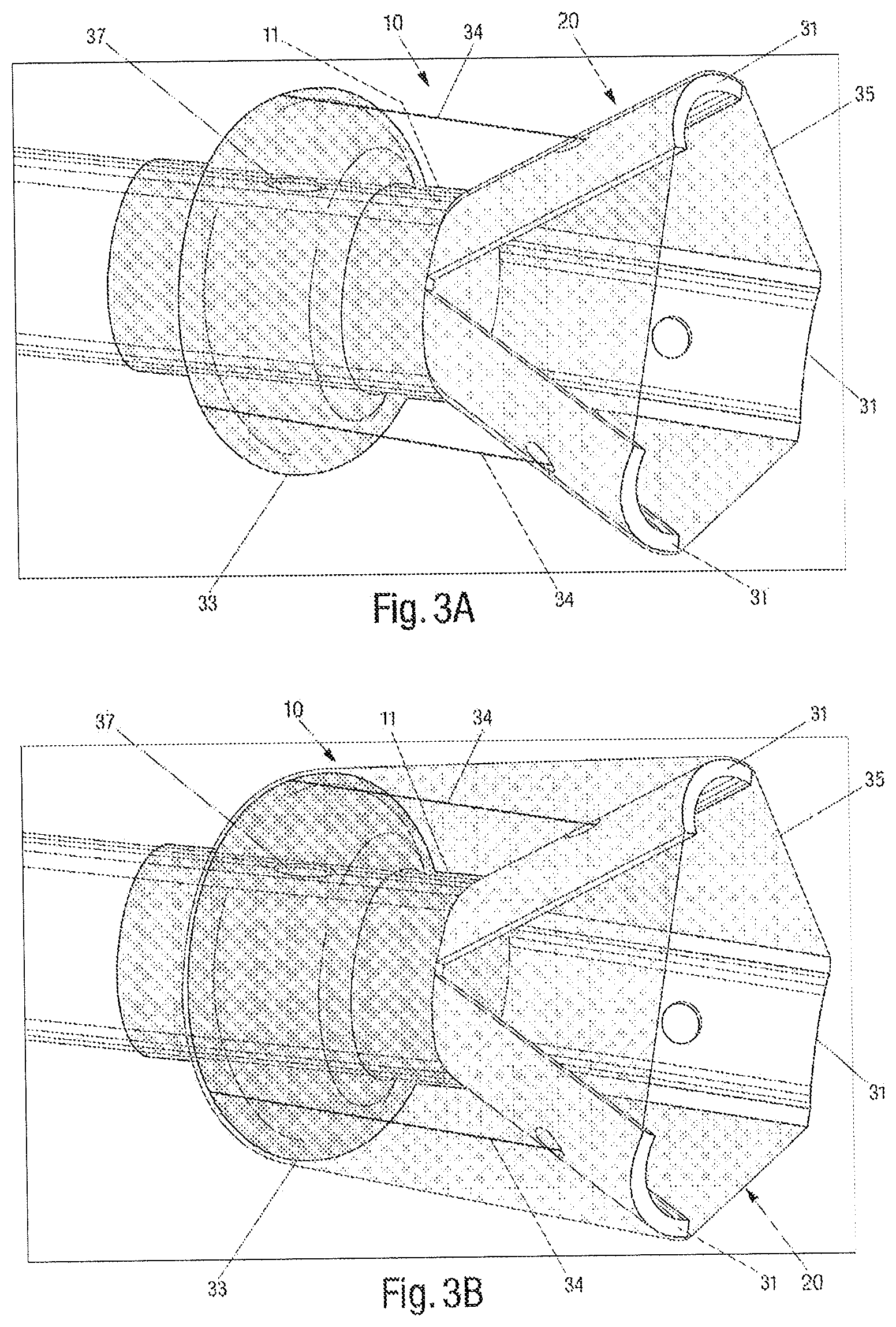 Patent US12616489 Figure 6 – Systems and methods for removing undesirable material within a circulatory system during a surgical procedure