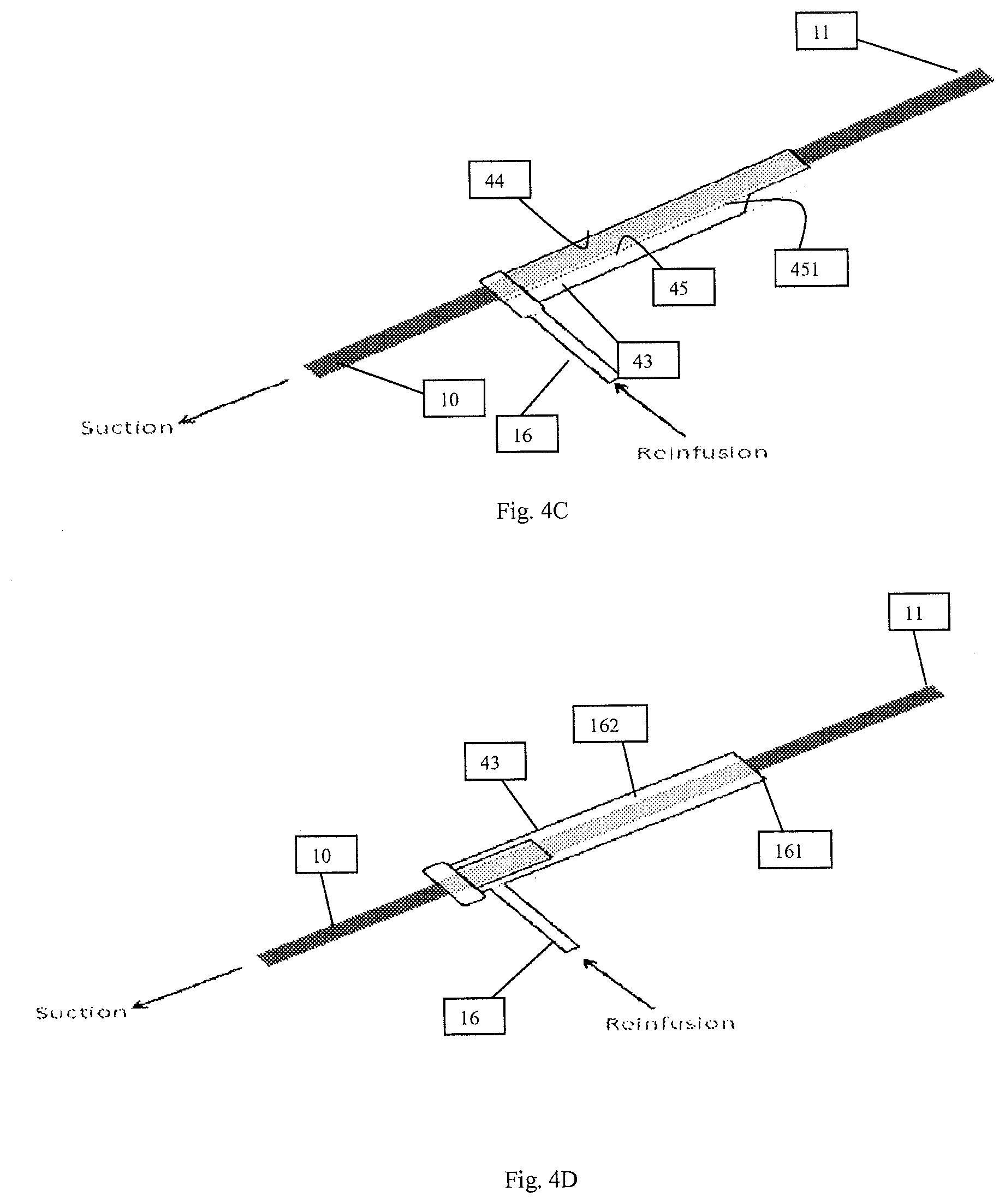 Patent US12616489 Figure 8 – Systems and methods for removing undesirable material within a circulatory system during a surgical procedure