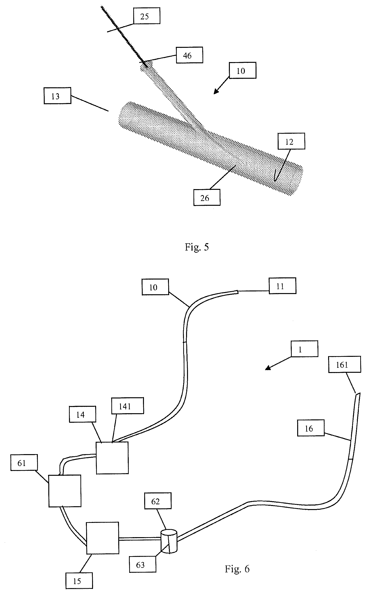 Patent US12616489 Figure 10 – Systems and methods for removing undesirable material within a circulatory system during a surgical procedure