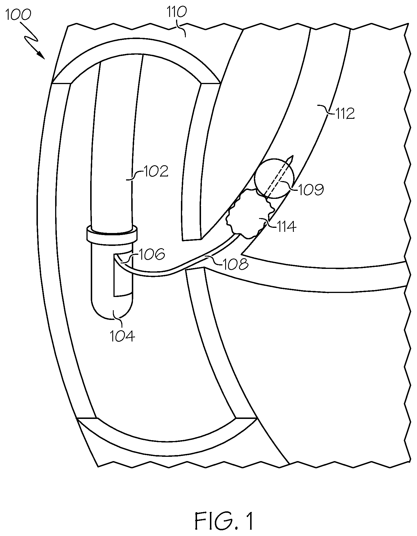 Patent US12616491 Figure 1 – Medical devices and related methods thereof