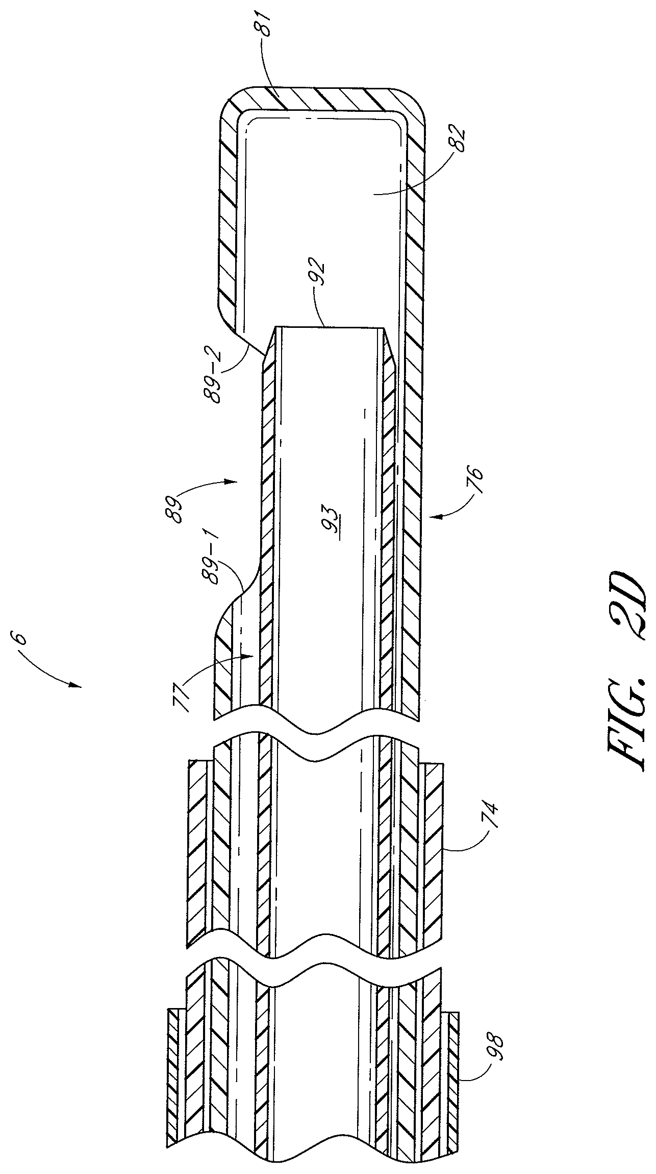 Patent US12616494 Figure 5 – Uterine fibroid tissue removal device