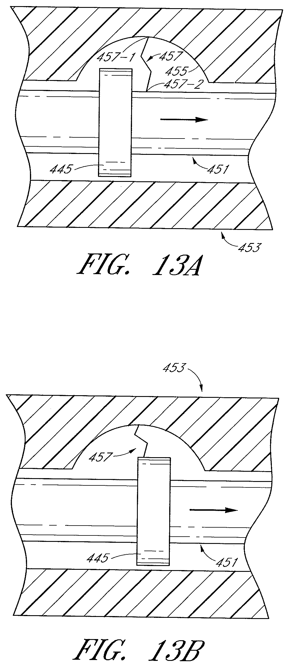 Patent US12616494 Figure 15 – Uterine fibroid tissue removal device