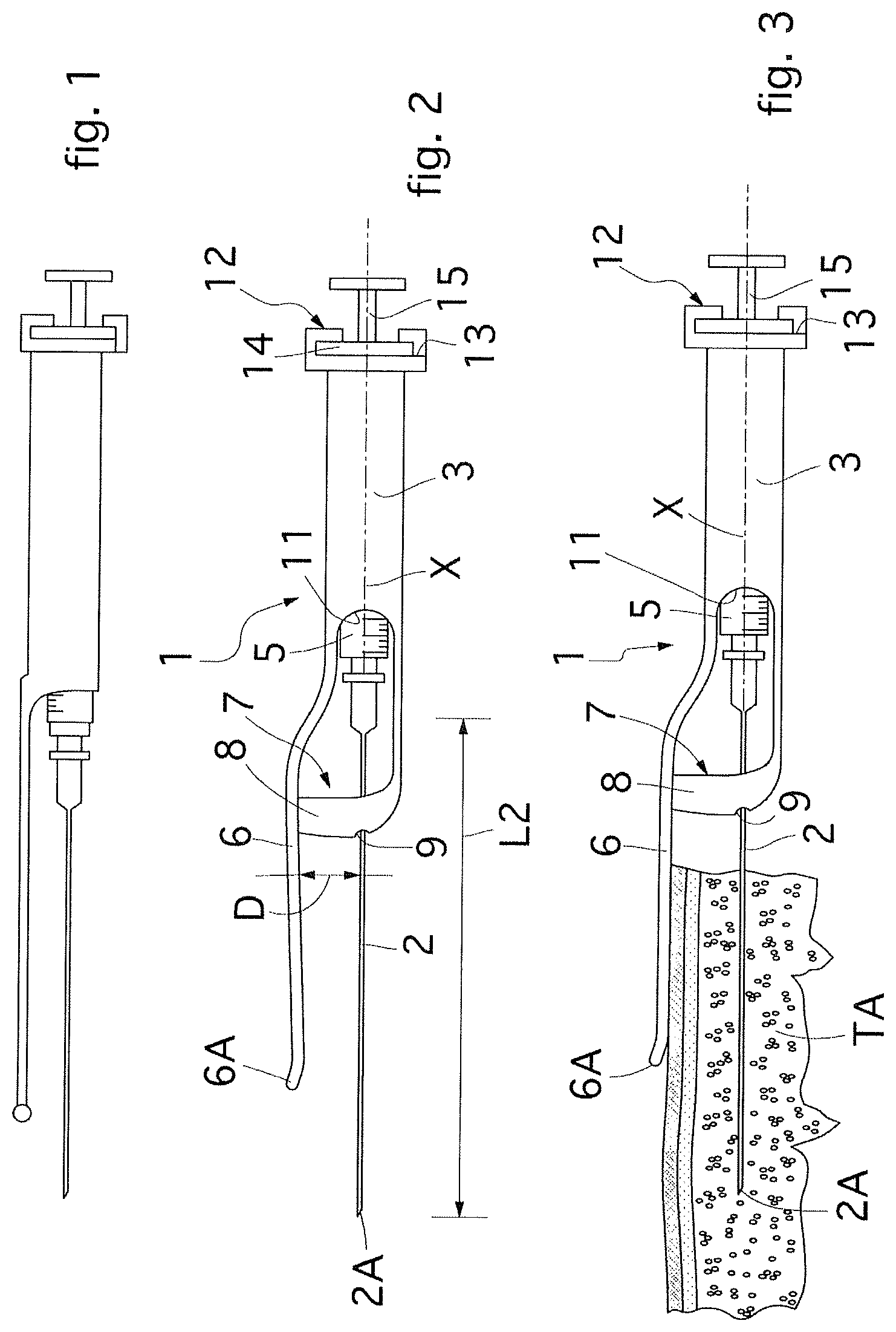 Patent US12616498 Figure 1 – Guide device for cannulas for the collection of micro-fragmented subcutaneous adipose tissue