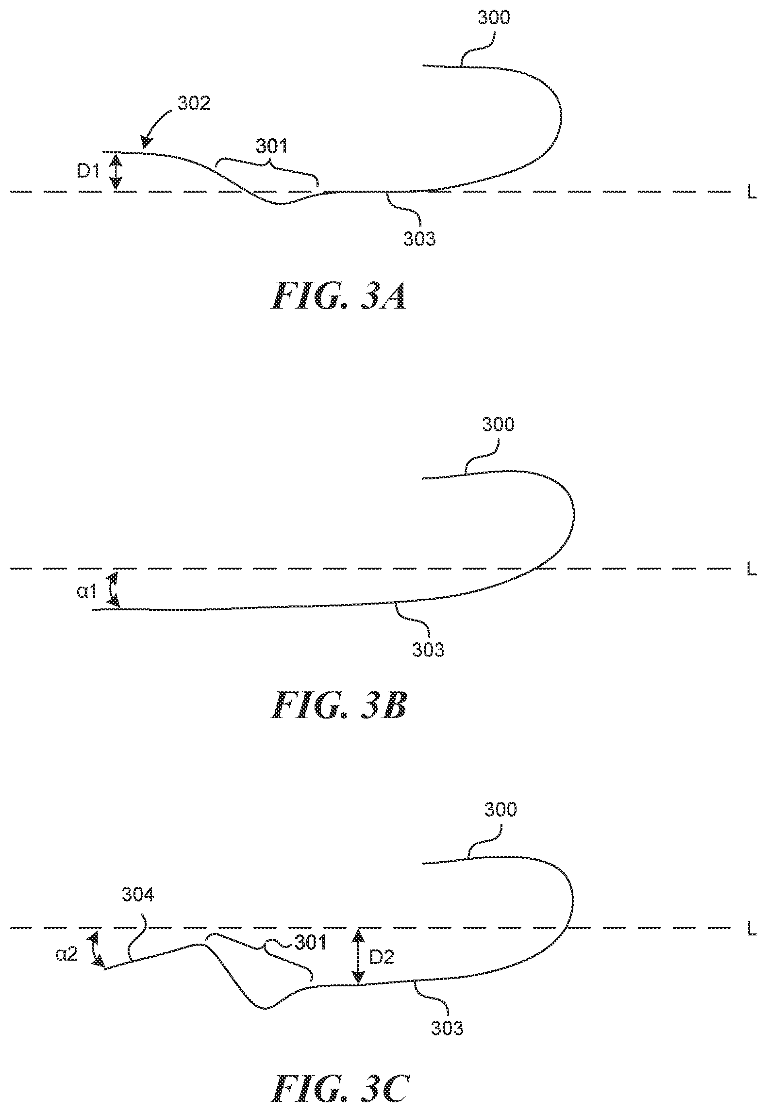Patent US12616499 Figure 2 – Systems and methods for endoluminal valve creation