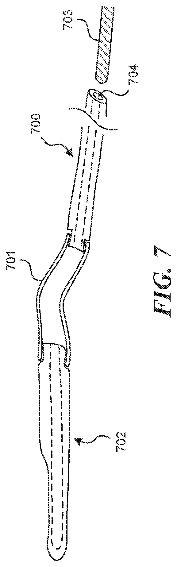 Patent US12616499 Figure 6 – Systems and methods for endoluminal valve creation