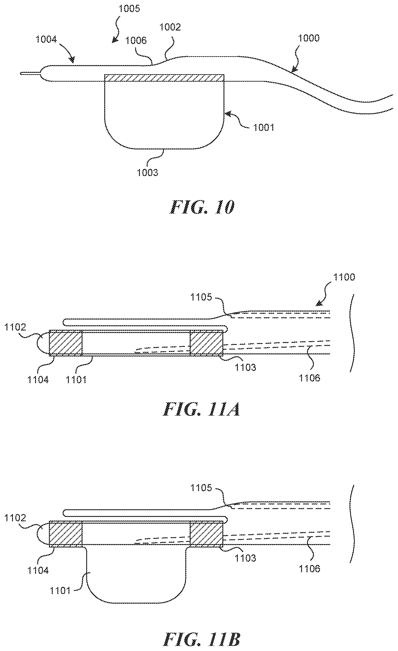 Patent US12616499 Figure 9 – Systems and methods for endoluminal valve creation