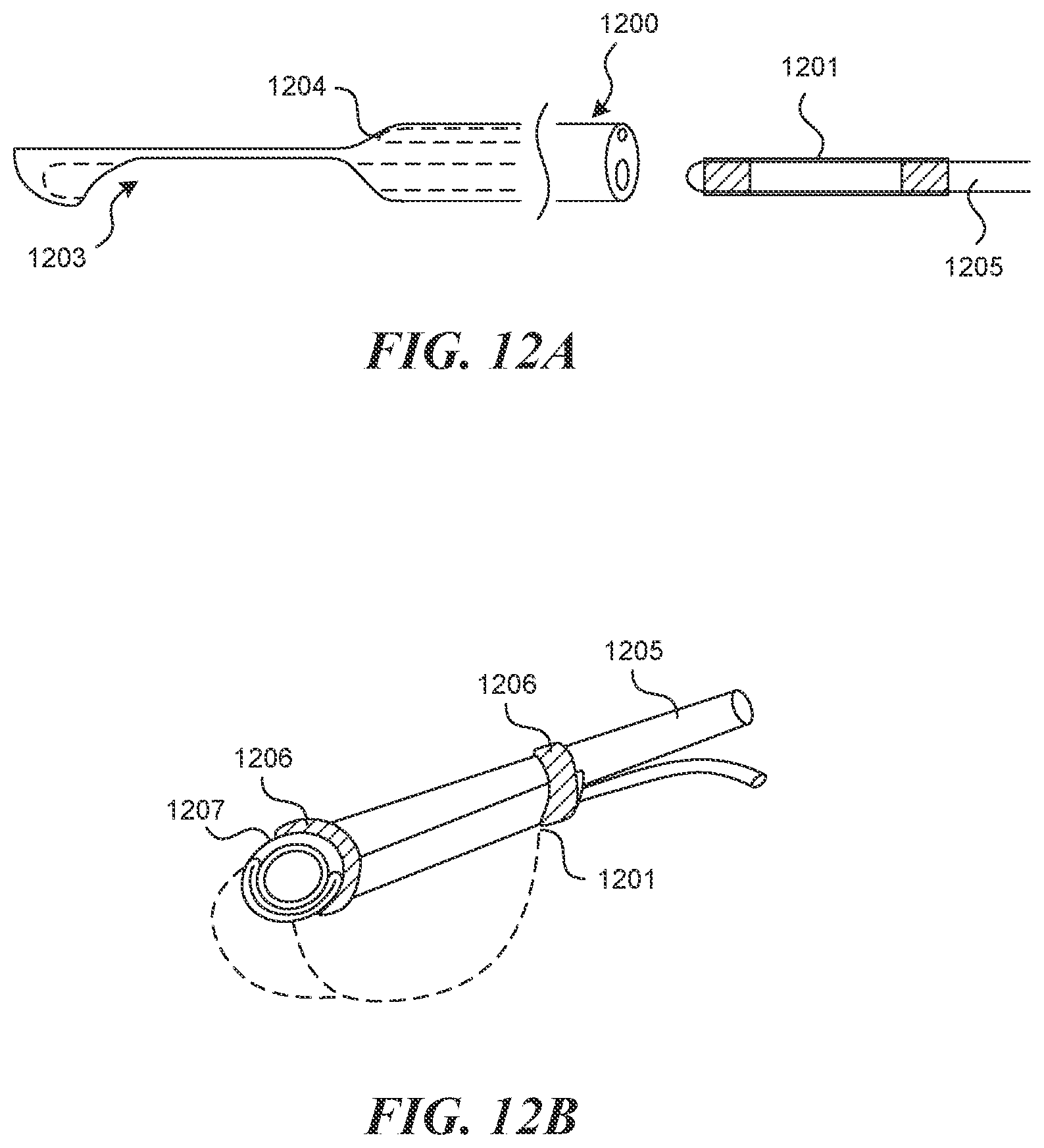 Patent US12616499 Figure 10 – Systems and methods for endoluminal valve creation