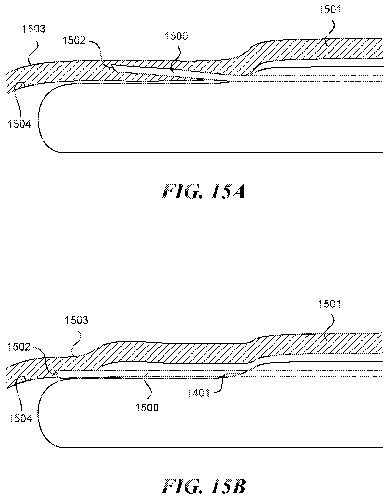 Patent US12616499 Figure 13 – Systems and methods for endoluminal valve creation