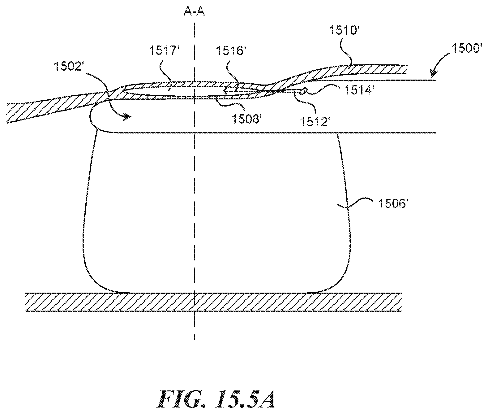 Patent US12616499 Figure 14 – Systems and methods for endoluminal valve creation