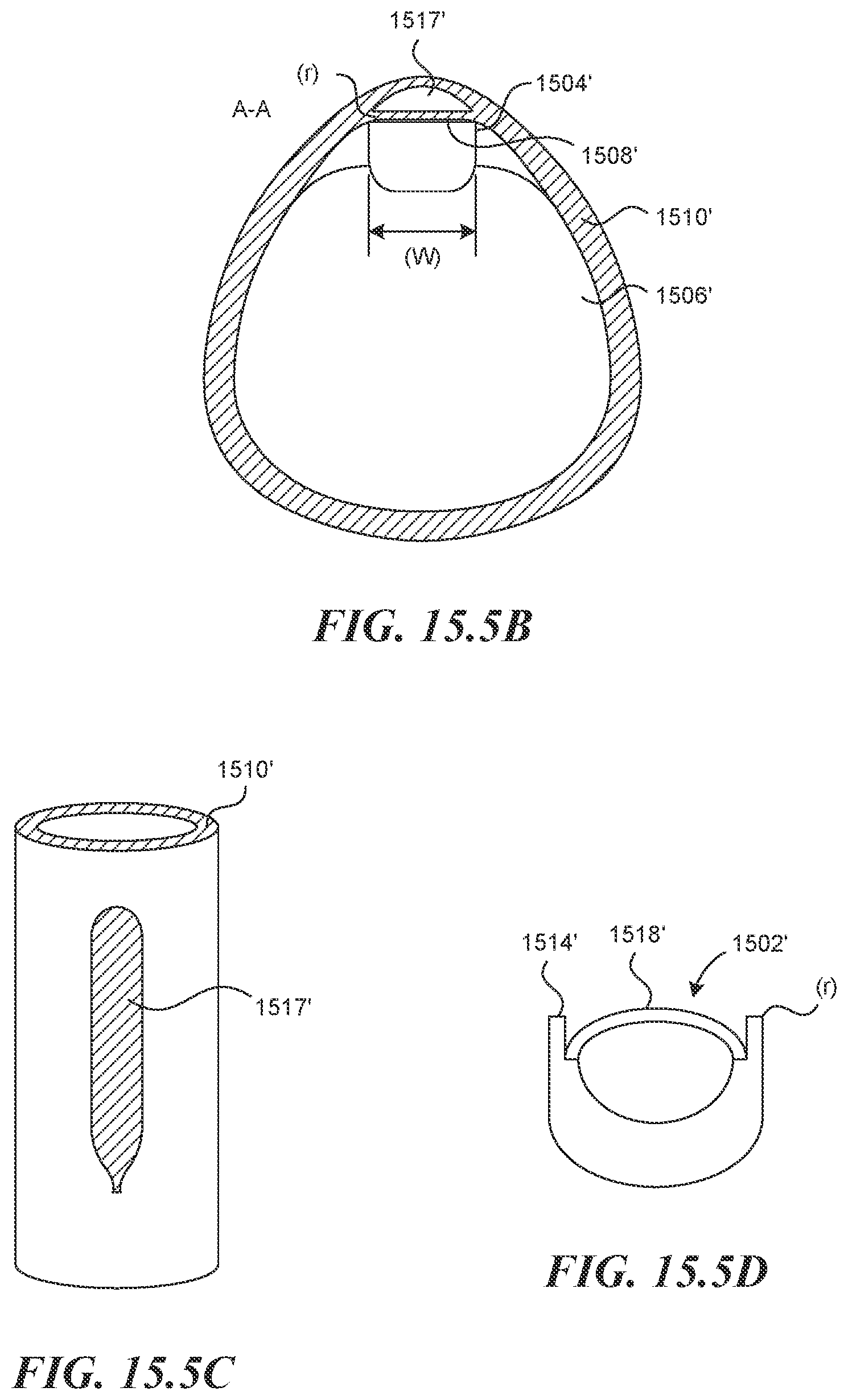 Patent US12616499 Figure 15 – Systems and methods for endoluminal valve creation