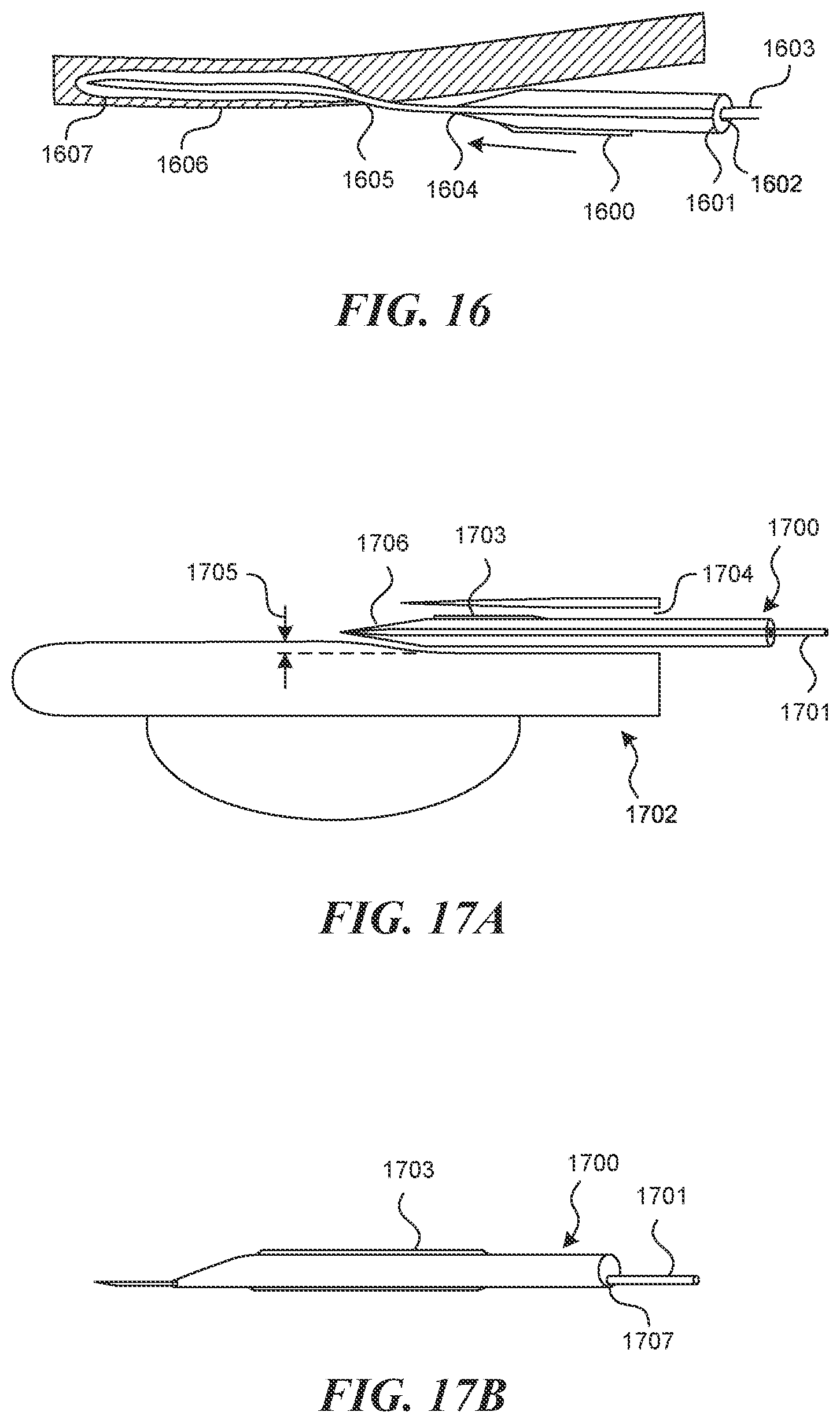Patent US12616499 Figure 16 – Systems and methods for endoluminal valve creation