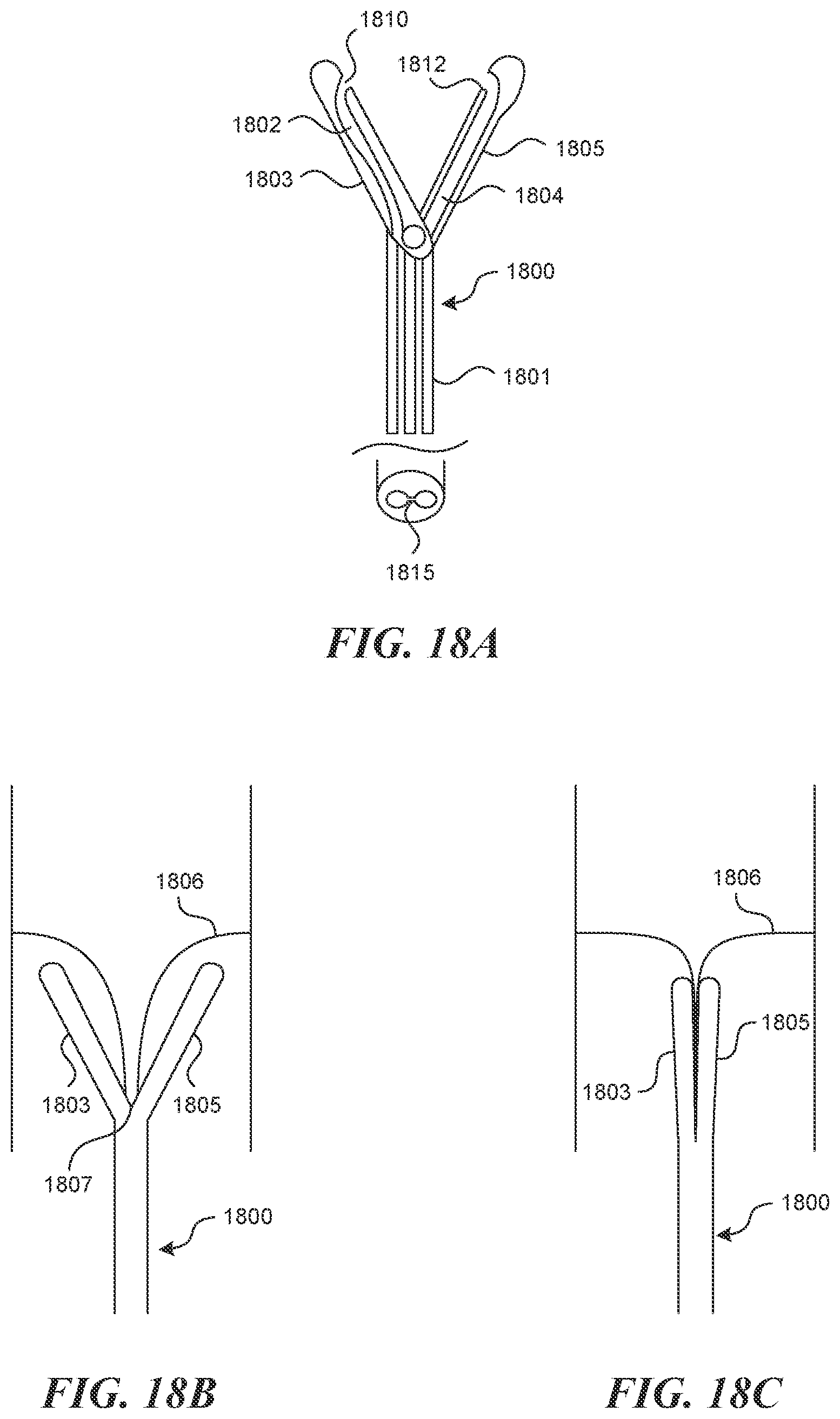 Patent US12616499 Figure 17 – Systems and methods for endoluminal valve creation