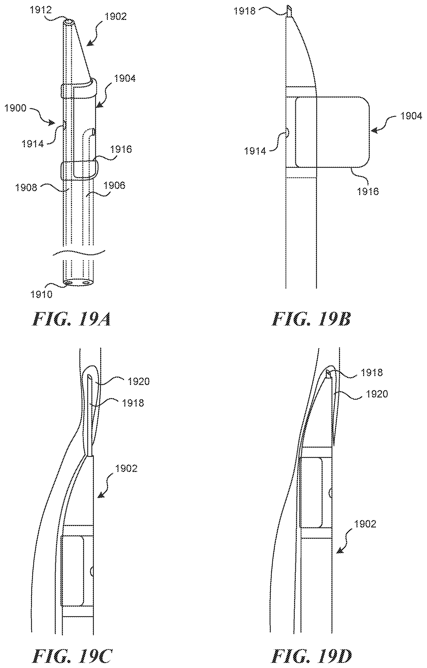 Patent US12616499 Figure 19 – Systems and methods for endoluminal valve creation