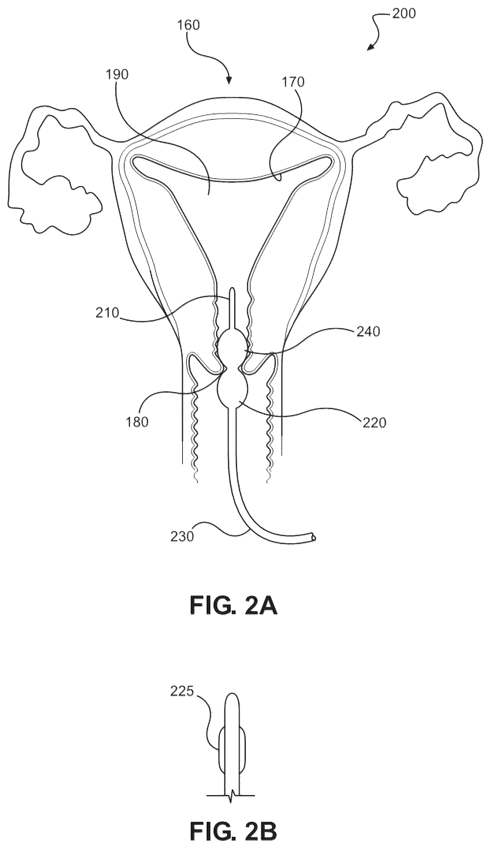 Patent US12616503 Figure 2 – Methods for postpartum uterine hemostasis