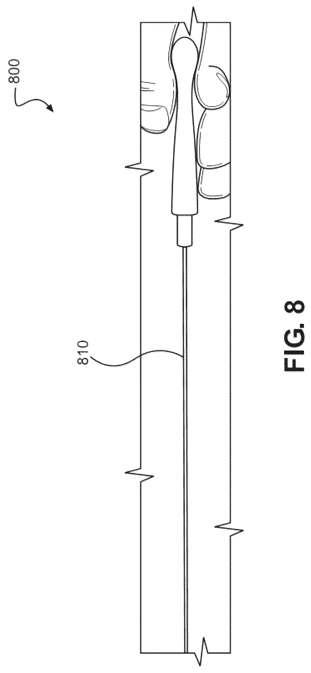 Patent US12616503 Figure 8 – Methods for postpartum uterine hemostasis