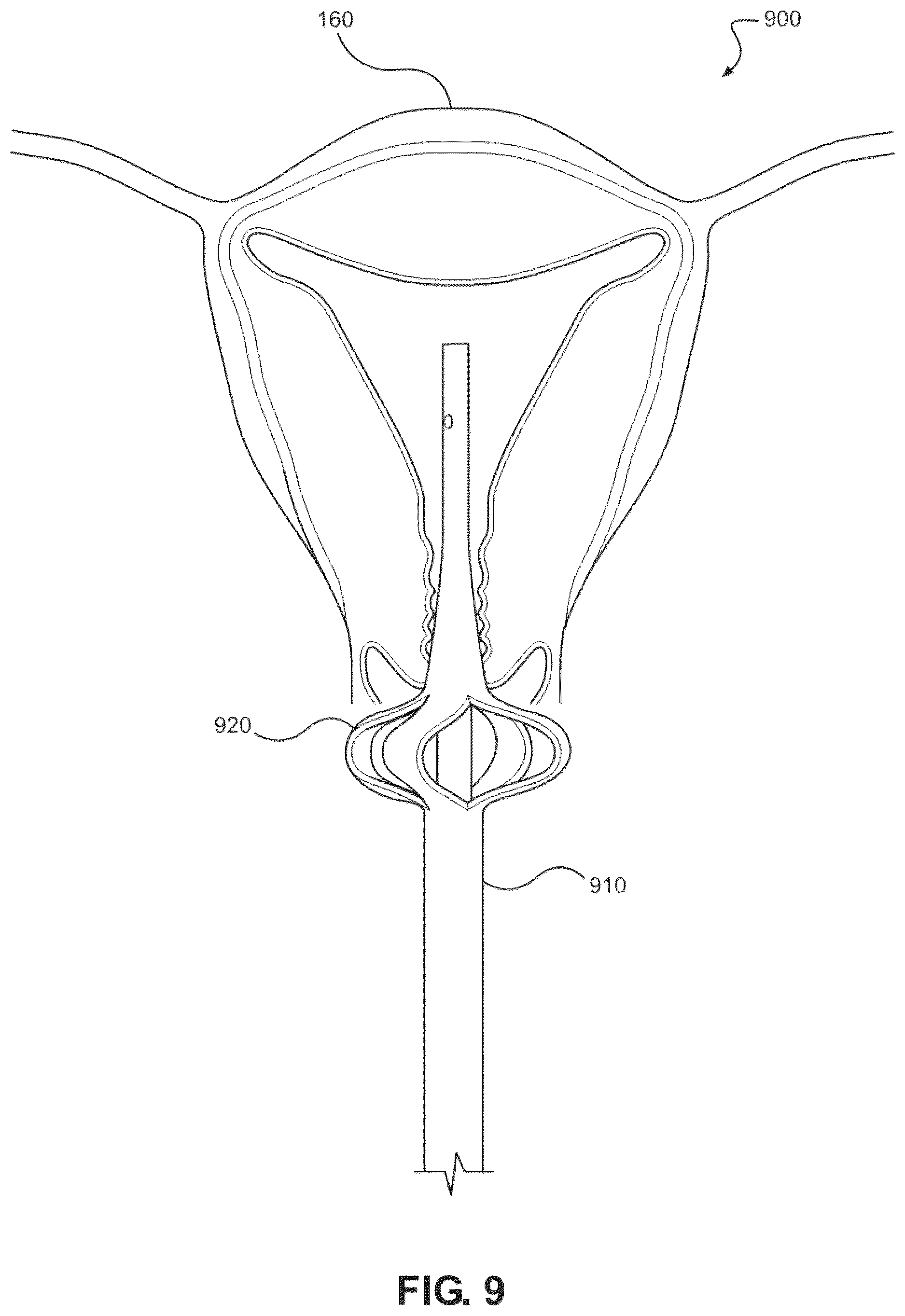 Patent US12616503 Figure 9 – Methods for postpartum uterine hemostasis