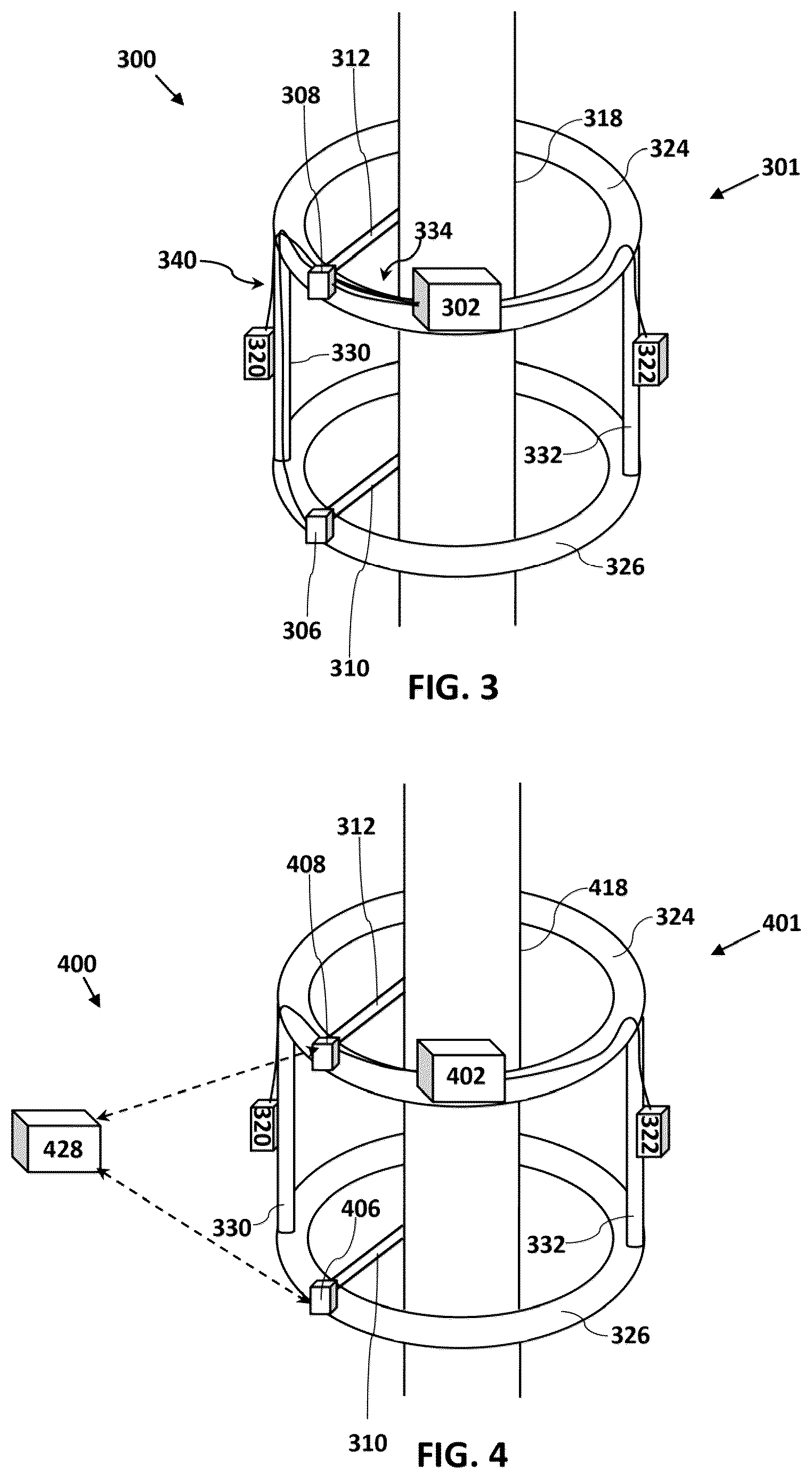 Patent US12616505 Figure 2 – Accordion maneuver with a bone fixation device