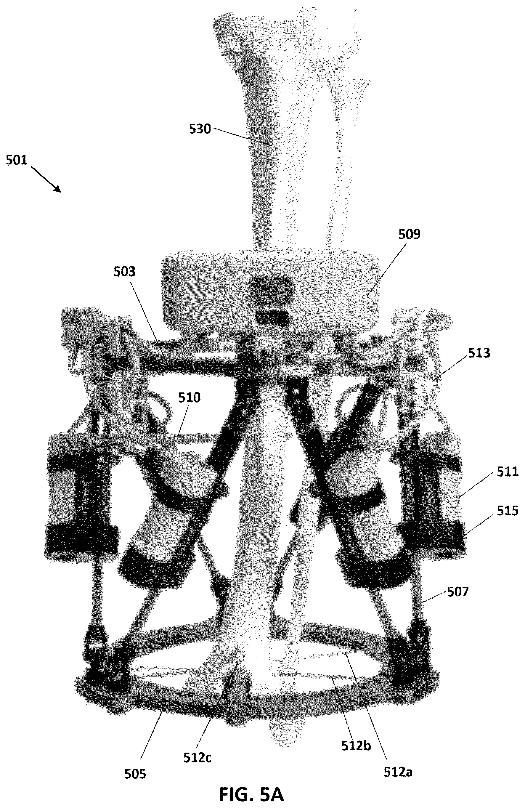 Patent US12616505 Figure 3 – Accordion maneuver with a bone fixation device