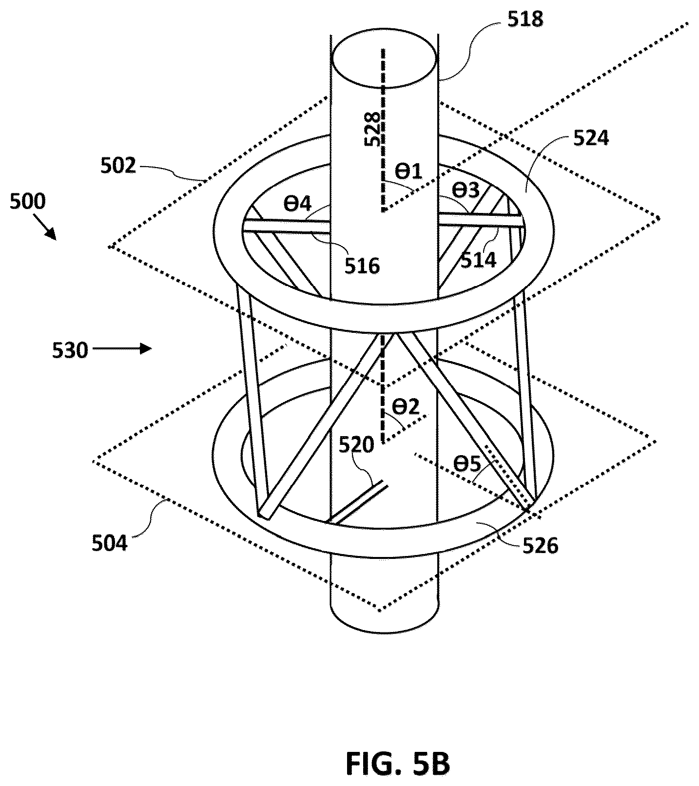 Patent US12616505 Figure 4 – Accordion maneuver with a bone fixation device