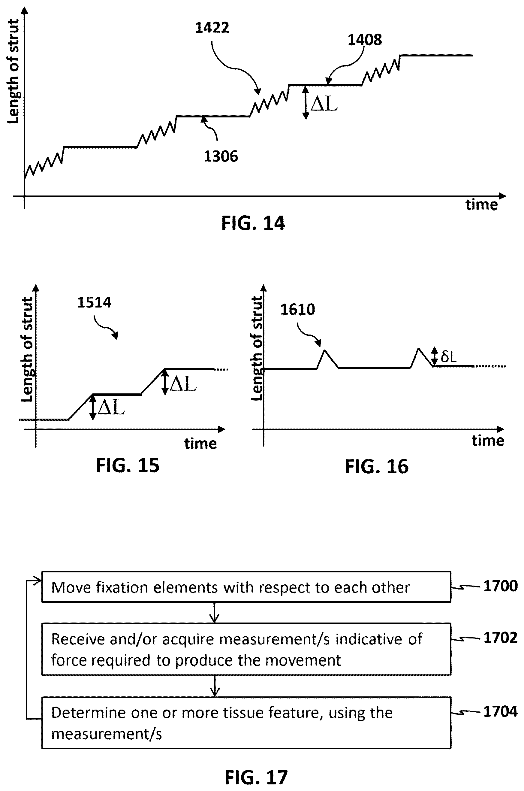 Patent US12616505 Figure 10 – Accordion maneuver with a bone fixation device