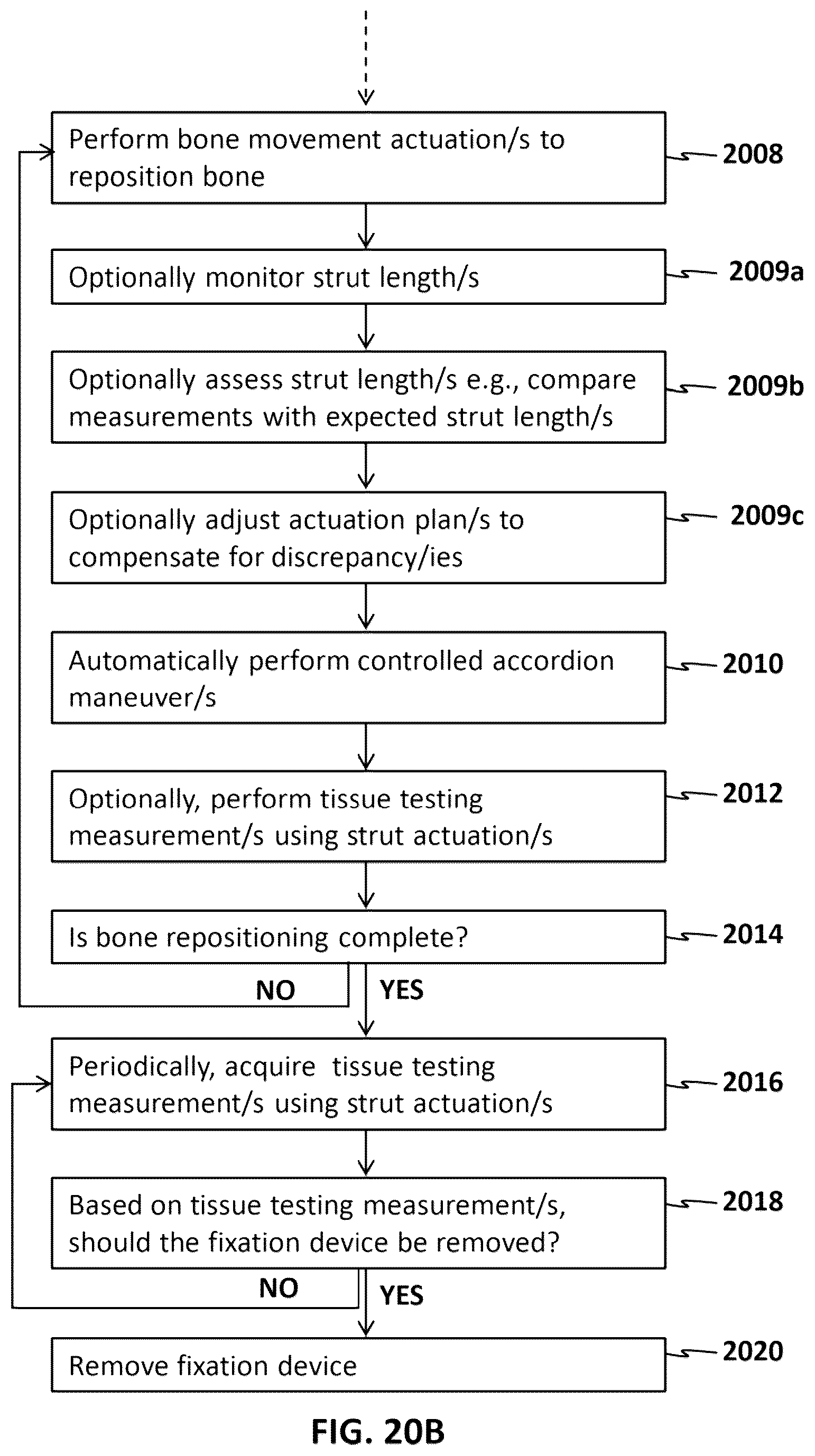 Patent US12616505 Figure 13 – Accordion maneuver with a bone fixation device