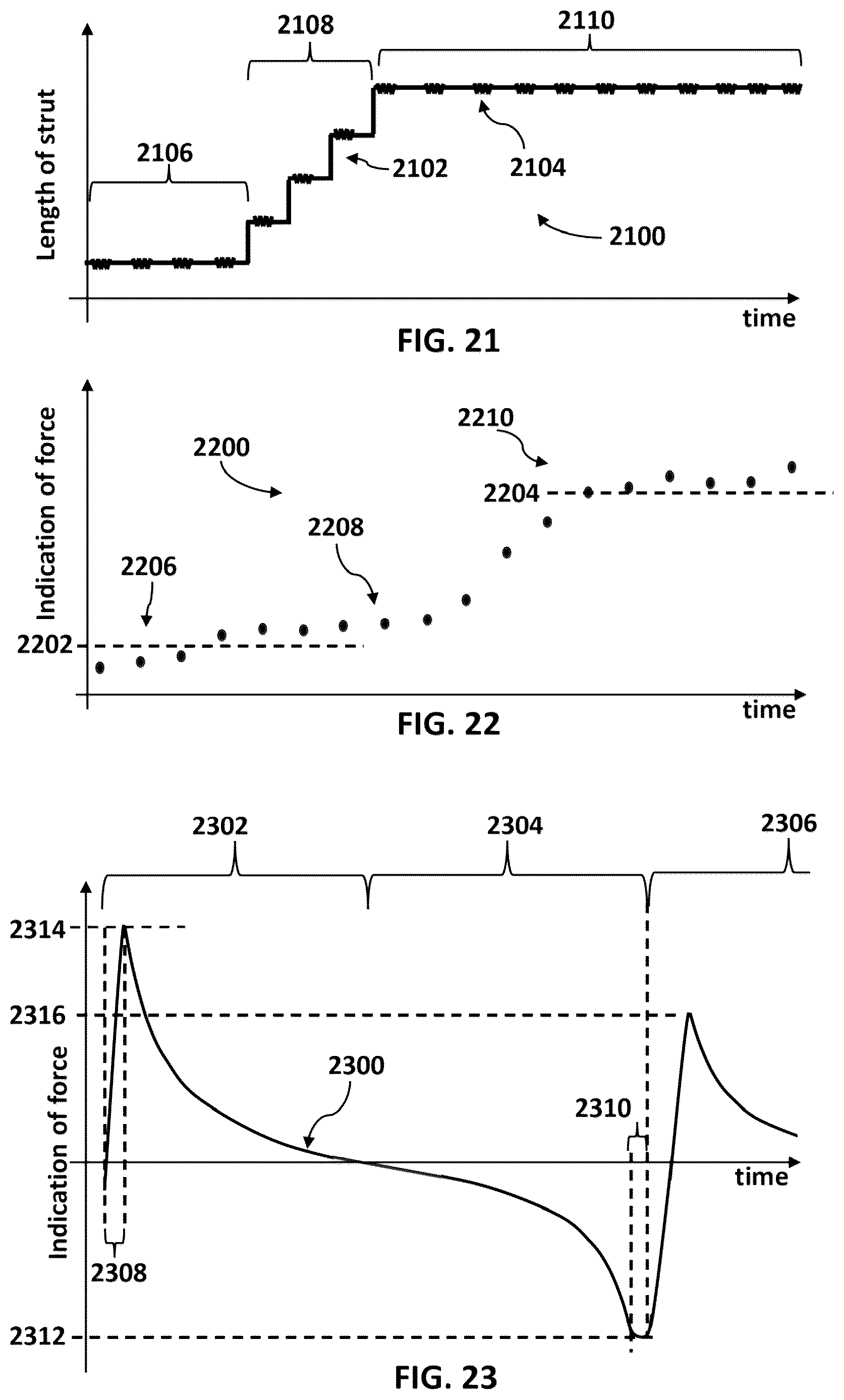 Patent US12616505 Figure 14 – Accordion maneuver with a bone fixation device