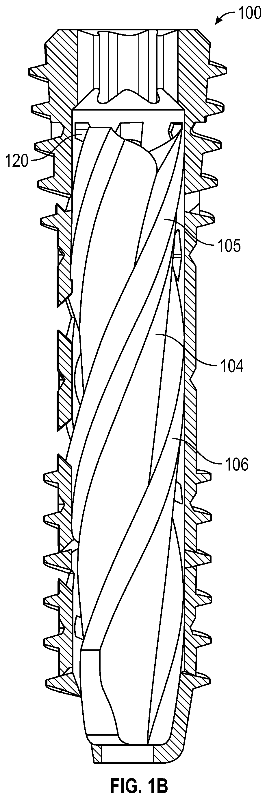 Patent US12616506 Figure 2 – Material directing orthopedic anchor