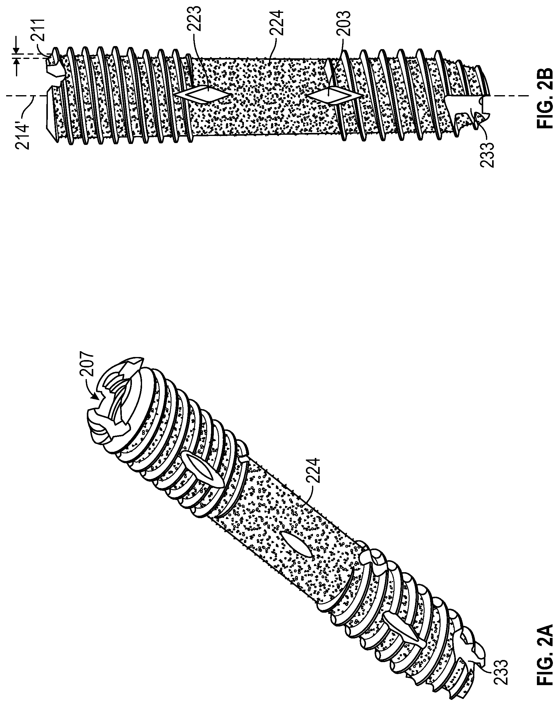 Patent US12616506 Figure 4 – Material directing orthopedic anchor