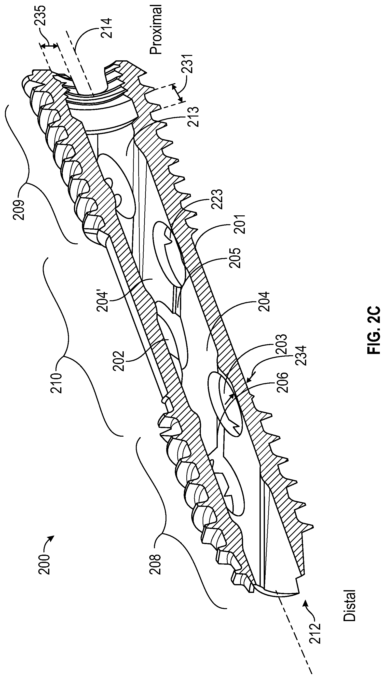 Patent US12616506 Figure 5 – Material directing orthopedic anchor