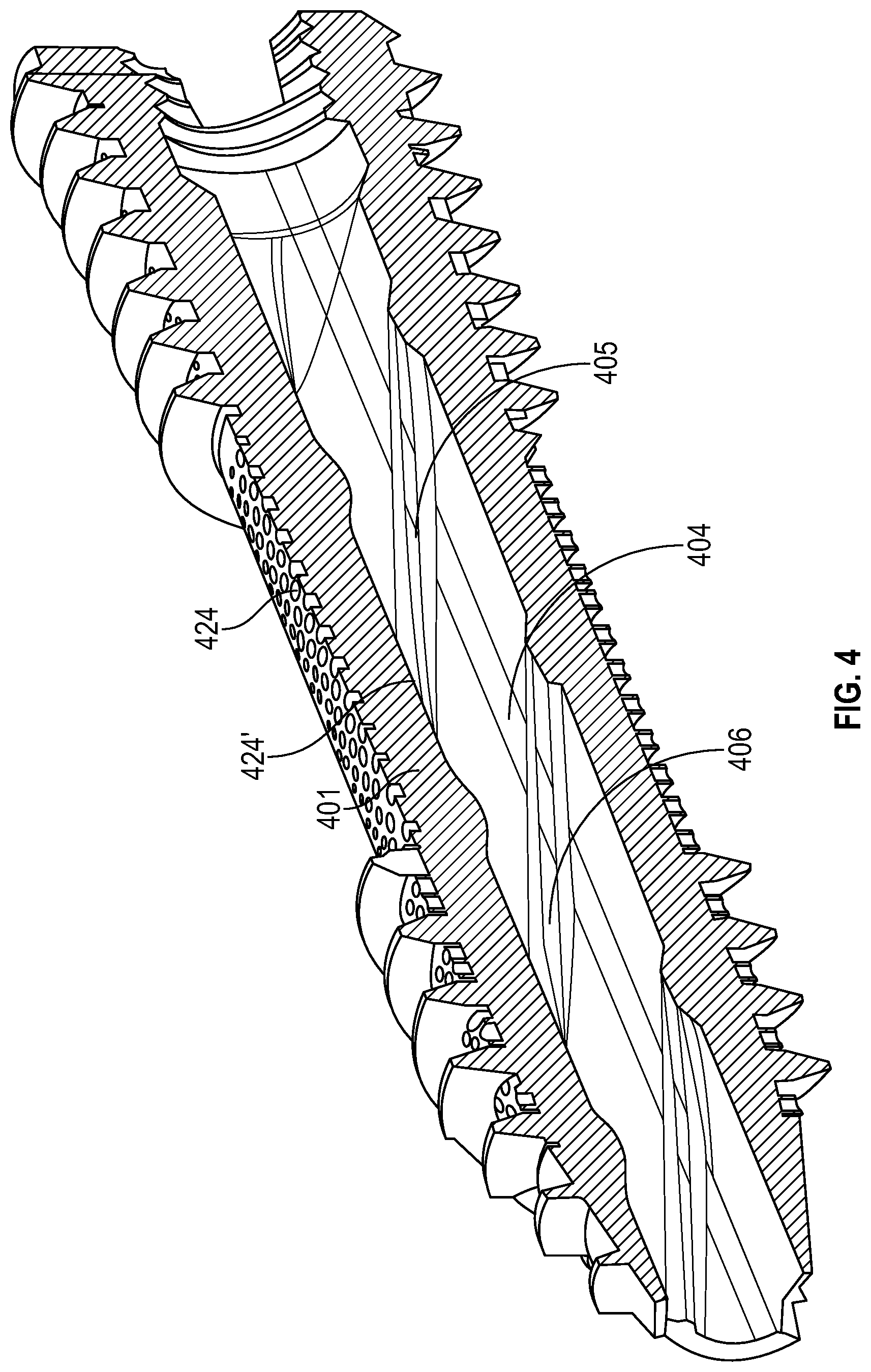 Patent US12616506 Figure 8 – Material directing orthopedic anchor