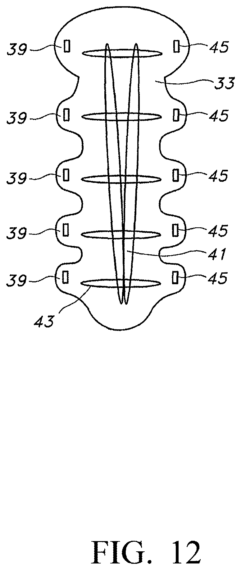 Patent US12616509 Figure 8 – Sternum fixation device and method