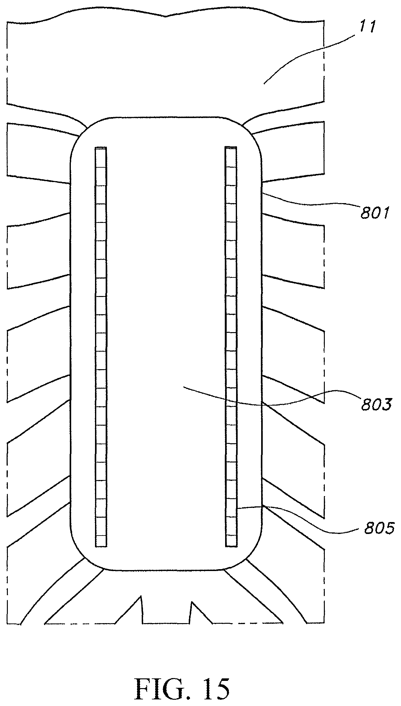 Patent US12616509 Figure 10 – Sternum fixation device and method