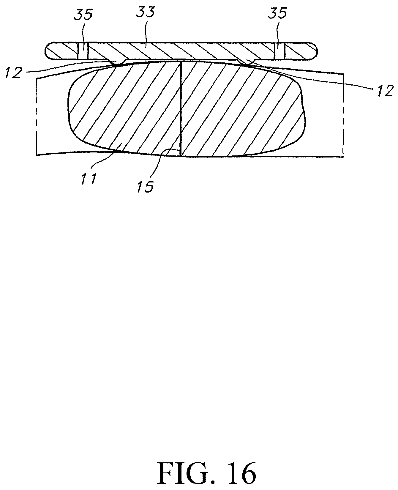 Patent US12616509 Figure 11 – Sternum fixation device and method