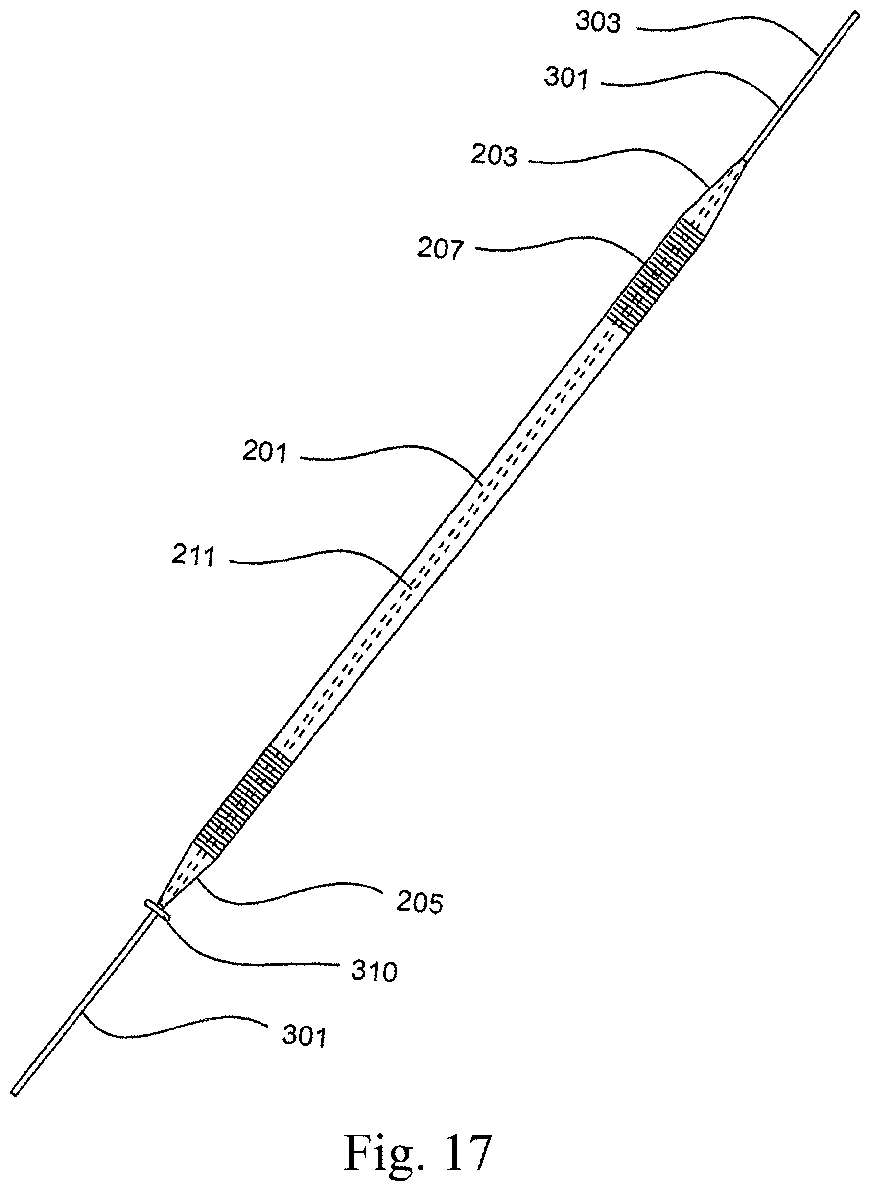 Patent US12616509 Figure 12 – Sternum fixation device and method
