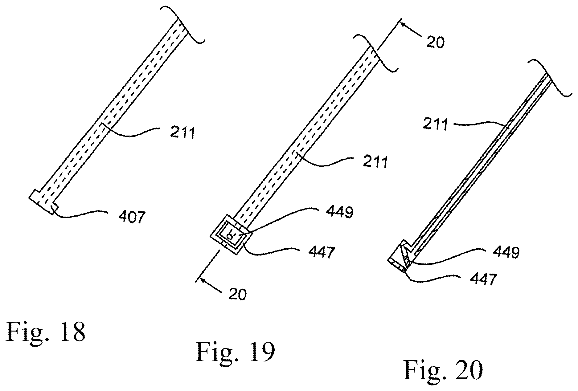 Patent US12616509 Figure 13 – Sternum fixation device and method