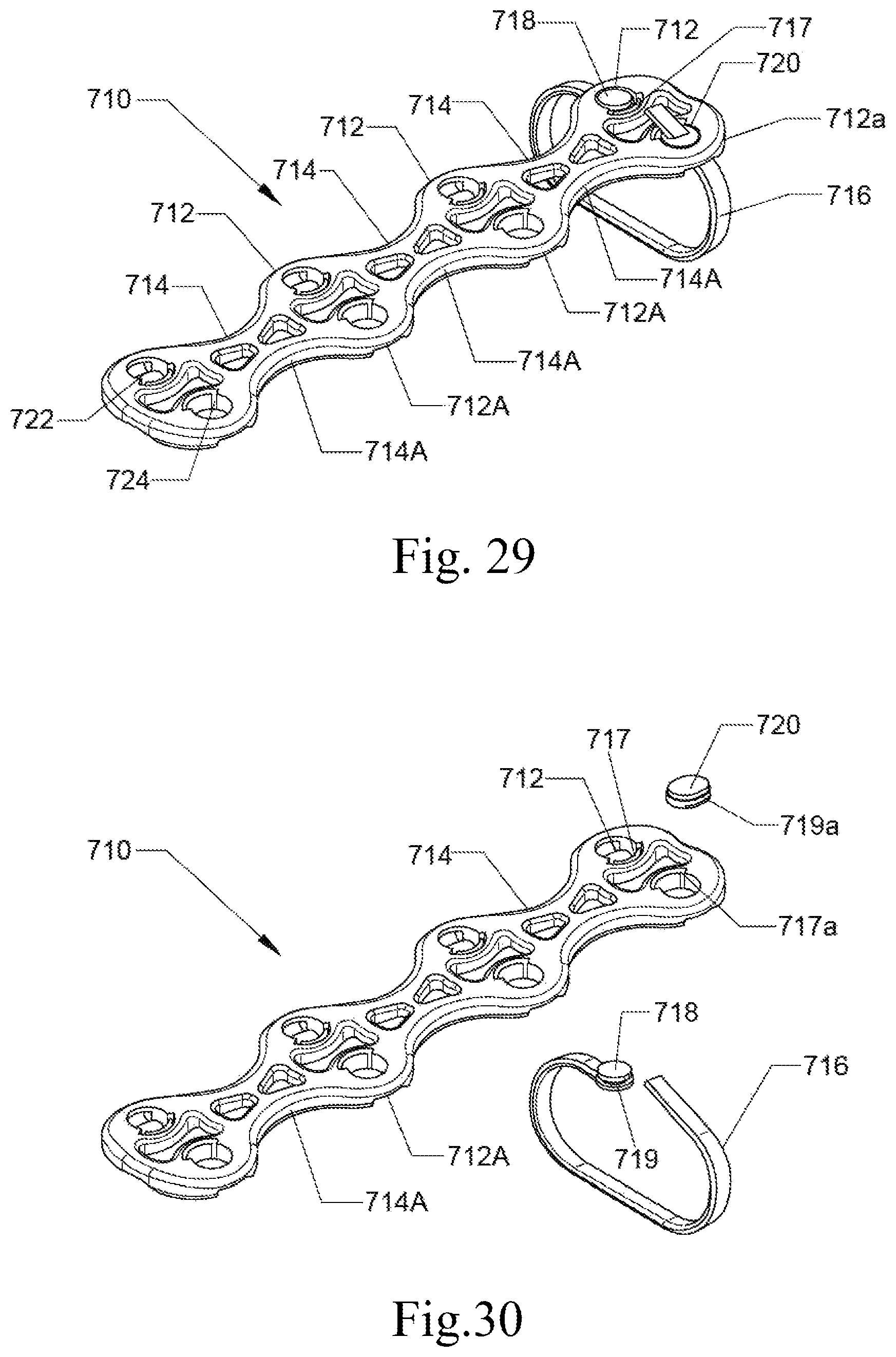 Patent US12616509 Figure 19 – Sternum fixation device and method