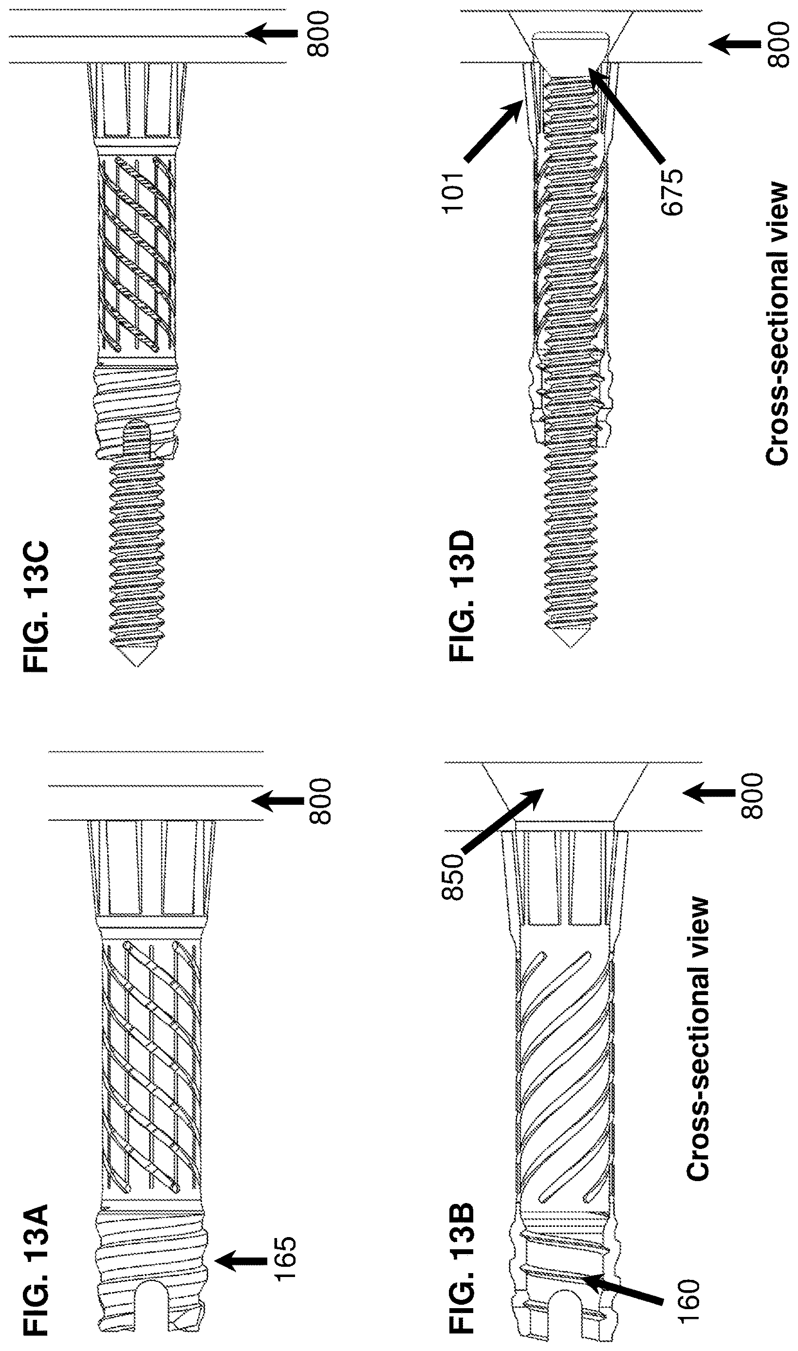 Patent US12616510 Figure 13 – Devices, systems, and methods for bone repair or implant fixation
