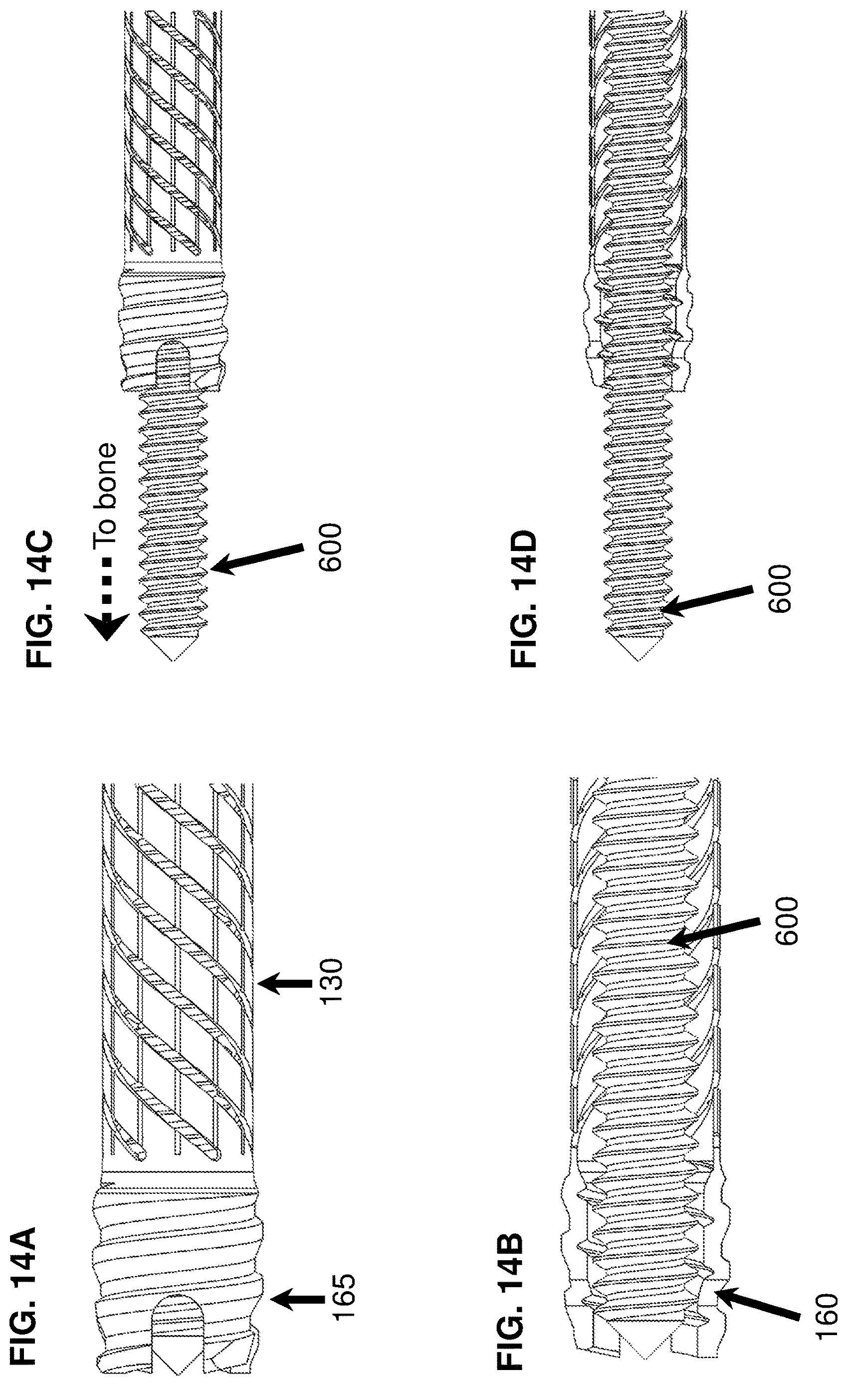Patent US12616510 Figure 14 – Devices, systems, and methods for bone repair or implant fixation