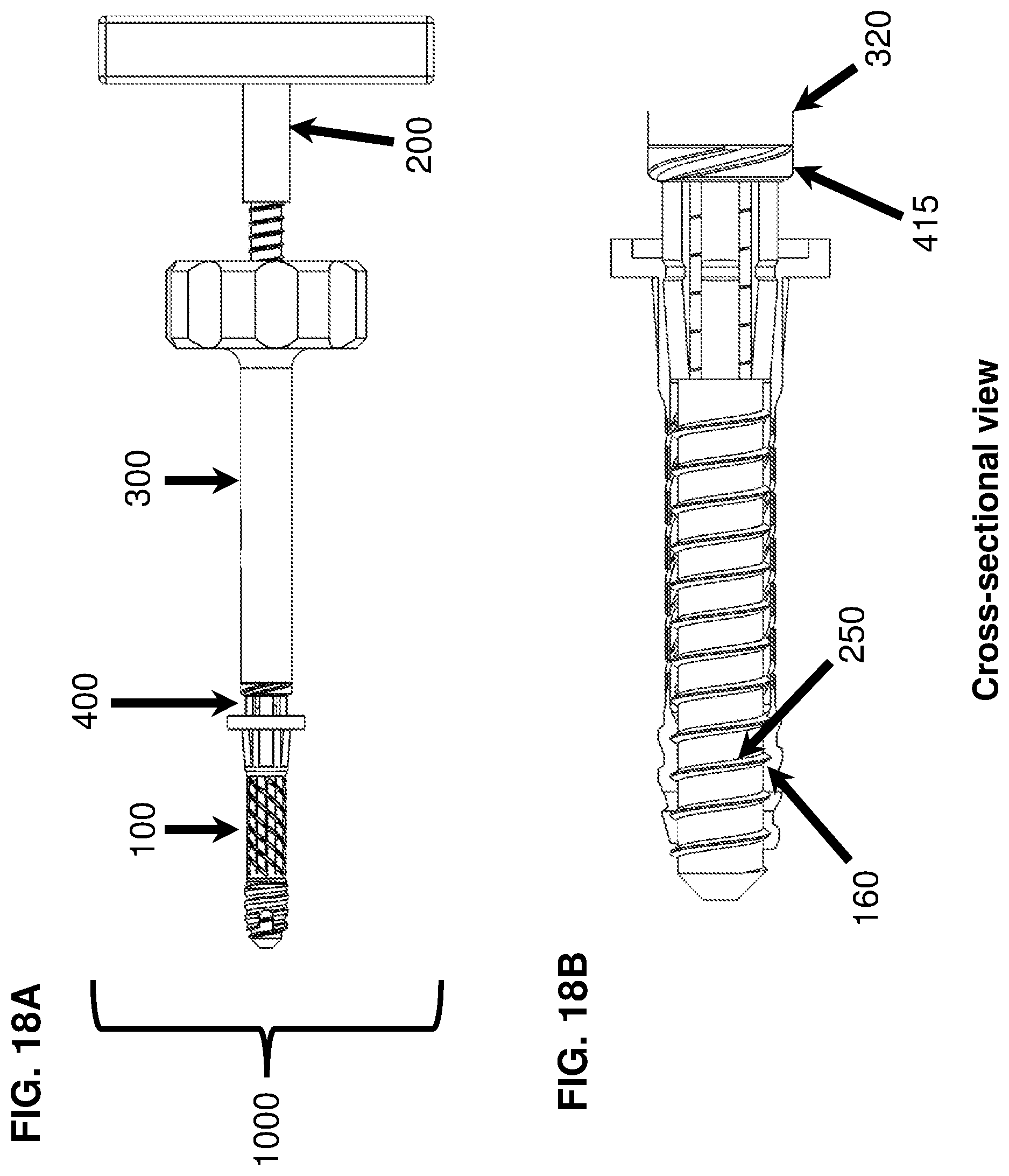 Patent US12616510 Figure 18 – Devices, systems, and methods for bone repair or implant fixation