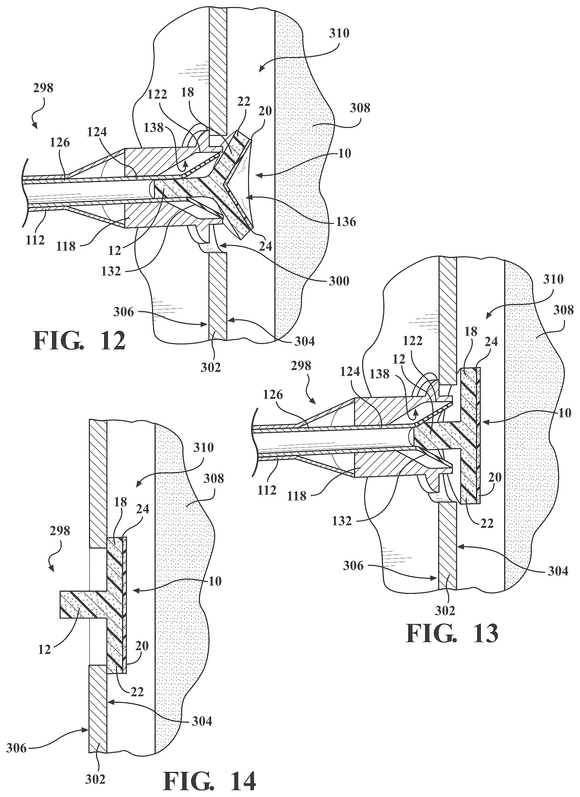 Patent US12616511 Figure 6 – Skull base closure systems and methods