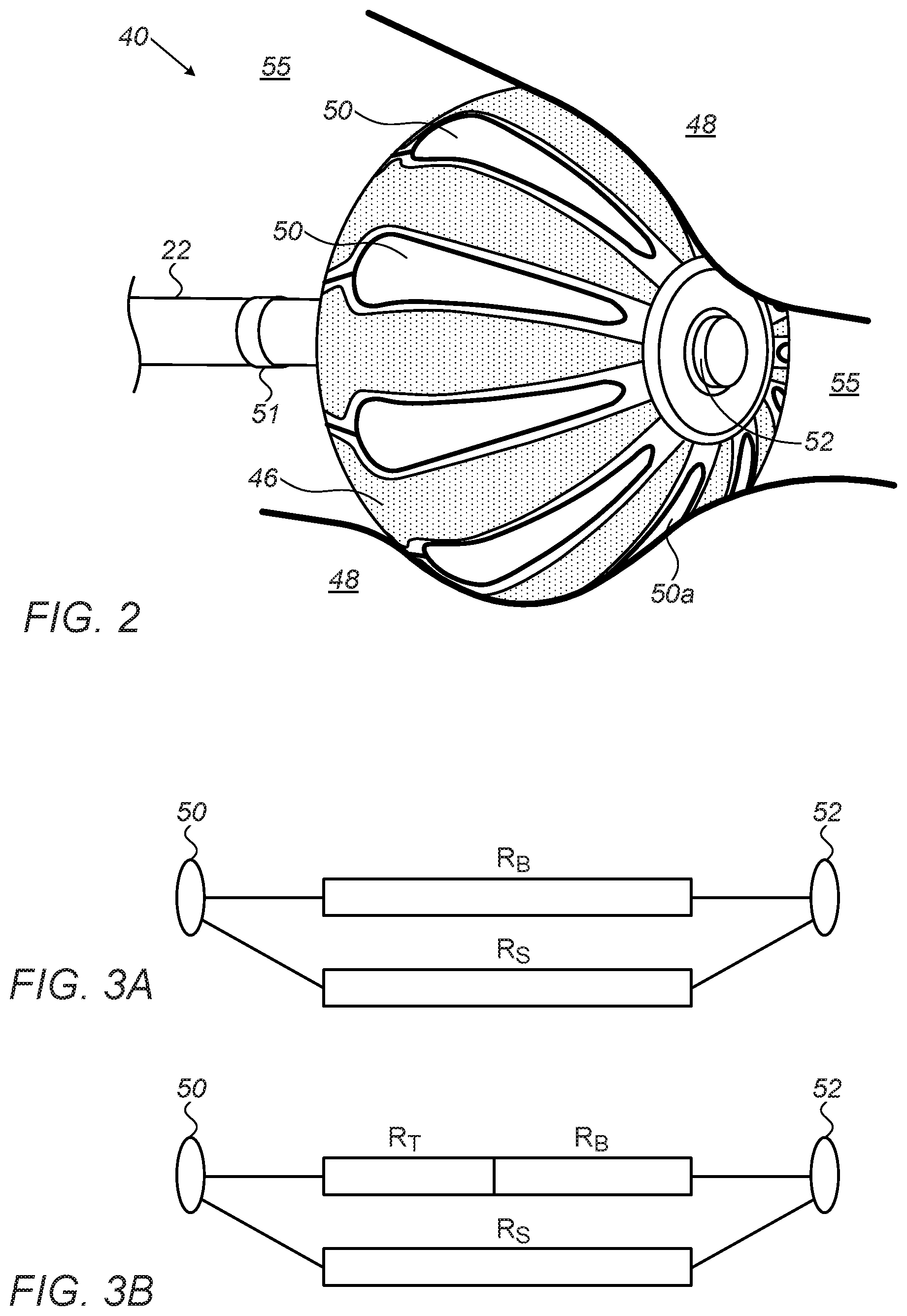 Patent US12616515 Figure 2 – Estimation of electrode-tissue contact using stem and edge electrodes