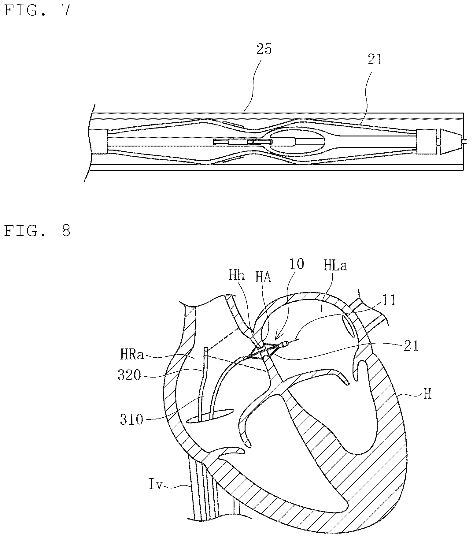 Patent US12616516 Figure 4 – Medical device