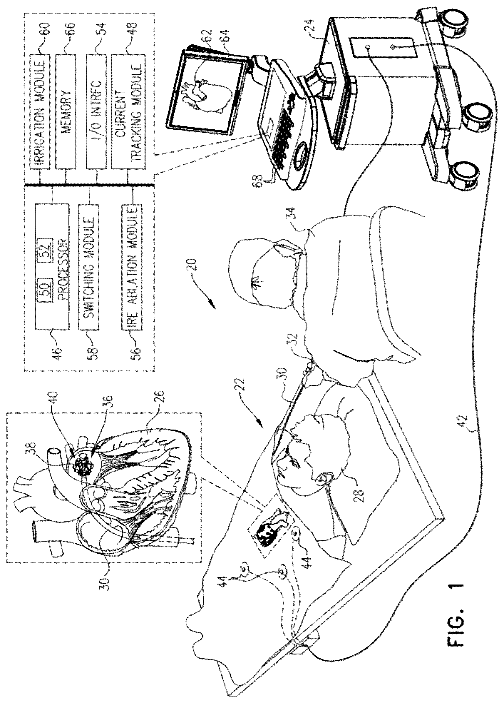 Patent US12616517 Figure 1 – Expandable basket assemblies with linear spine patterns for improved tissue contact and methods for making thereof