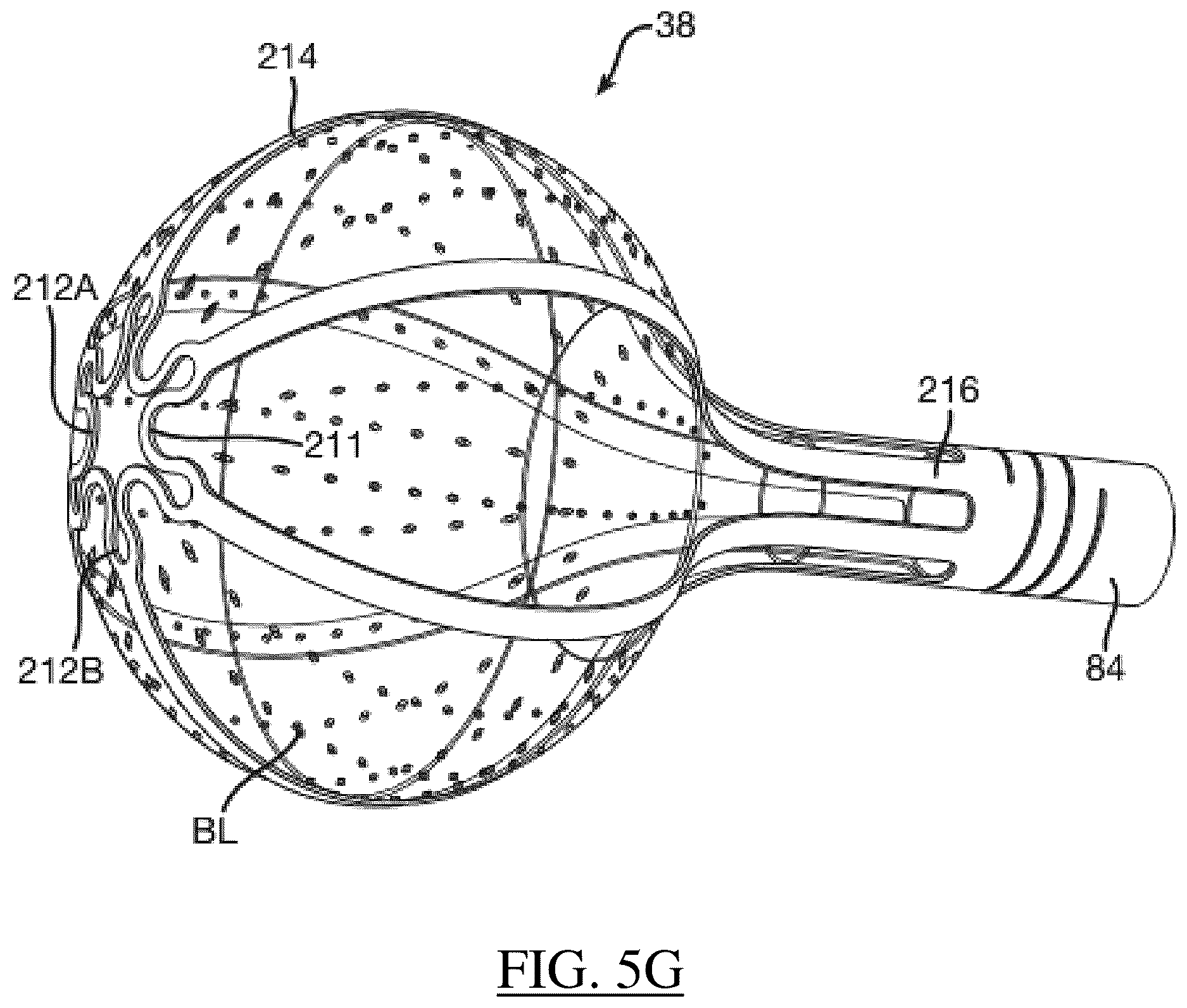 Patent US12616517 Figure 11 – Expandable basket assemblies with linear spine patterns for improved tissue contact and methods for making thereof