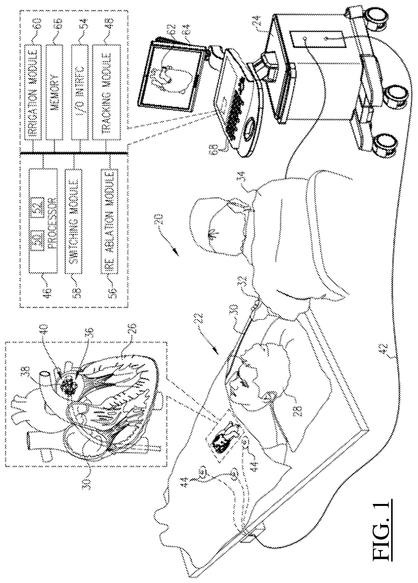 Patent US12616518 Figure 1 – Barrel electrodes for a basket catheter, and methods of the same