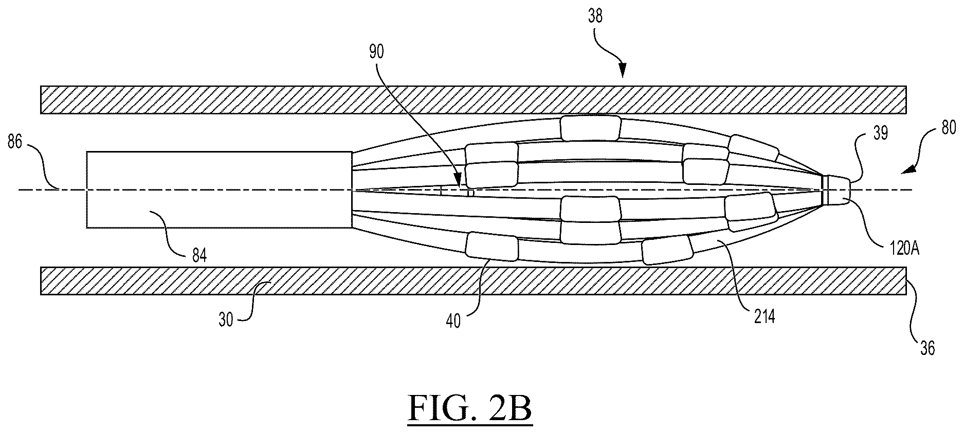Patent US12616519 Figure 3 – Basket assembly with atraumatic tip electrode and methods of making thereof